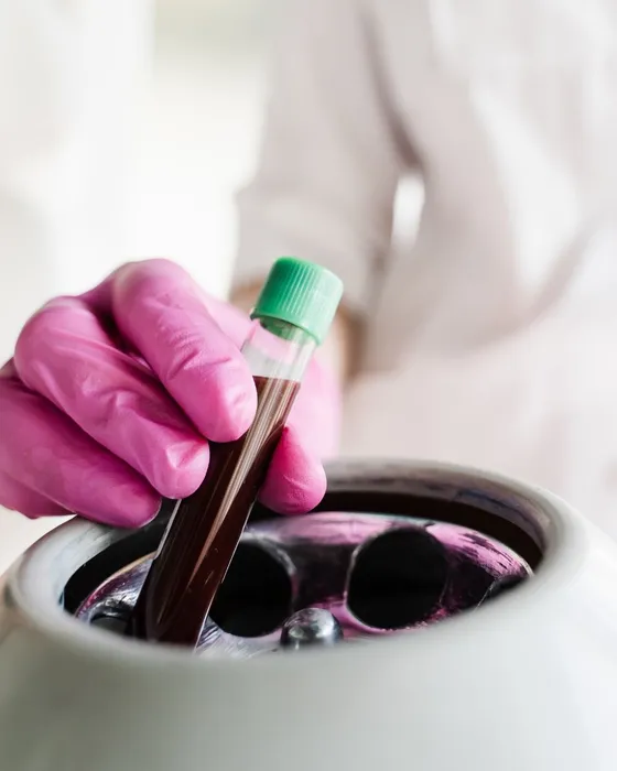 Cover for PRP Treatments in Glendale CA: How Platelet Rich Plasma Helps Skin and Hair Restoration